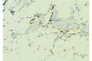 ABIN6276411 at 1/100 staining Human lung tissue by IHC-P. (ILK antibody  (C-Term))