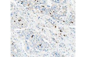 IHC analysis of CD68 using anti-CD68 antibody (ABIN7600142). (CD68 antibody  (AA 154-354))