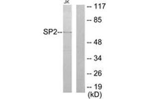 Western Blotting (WB) image for anti-Sp2 Transcription Factor (Sp2) (AA 471-520) antibody (ABIN2889540) (Sp2 antibody  (AA 471-520))