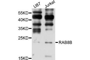 Western blot analysis of extracts of various cell lines, using RAB8B antibody (ABIN1875675) at 1:1000 dilution. (RAB8B antibody)