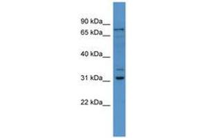 Image no. 1 for anti-F-Box Protein 34 (FBXO34) (AA 71-120) antibody (ABIN6746487) (FBXO34 antibody  (AA 71-120))