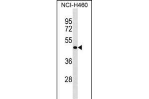 SG Antibody (N-term) (ABIN1539497 and ABIN2849755) western blot analysis in NCI- cell line lysates (35 μg/lane). (SGPP2 antibody  (N-Term))