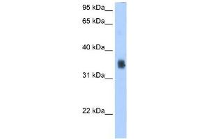 SLC35F2 antibody used at 2. (SLC35F2 antibody  (N-Term))