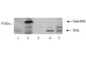 Image no. 1 for anti-Polynucleotide Kinase 3'-Phosphatase (PNKP) (Internal Region) antibody (ABIN401253) (PNKP antibody  (Internal Region))