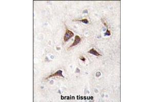 Formalin-fixed and paraffin-embedded human brain tissue reacted with CAMK2 delta Antibody , which was peroxidase-conjugated to the secondary antibody, followed by DAB staining. (CAMK2D antibody  (C-Term))