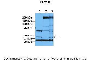 Lanes:   1: 30ug HeLa lysate, 2: 30ug HFF lysate, 3: 30ug U2OS lysate  Primary Antibody Dilution:   1:1000  Secondary Antibody:   Anti-rabbit HRP  Secondary Antibody Dilution:   1:5000  Gene Name:   PRMT8  Submitted by:   Dr. (PRMT8 antibody  (C-Term))