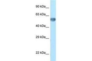 Image no. 1 for anti-Zinc Finger Protein 394 (ZNF394) (C-Term) antibody (ABIN6748078) (ZNF394 antibody  (C-Term))