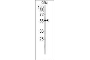 Western blot analysis of anti-PKM2 Antibody (C-term) in CEM cell line lysates (35ug/lane). (PKM2 antibody  (C-Term))