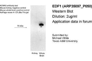 Western Blotting (WB) image for anti-Small Conductance Calcium-Activated Potassium Channel Protein 3 (KCNN3) (C-Term) antibody (ABIN183133) (KCNN3 antibody  (C-Term))