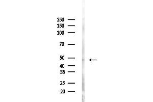 anti-D-2-Hydroxyglutarate Dehydrogenase (D2HGDH) (C-Term) antibody