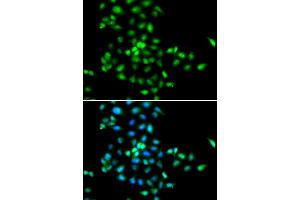 Immunofluorescence analysis of MCF-7 cells using SBDS antibody (ABIN5973483). (SBDS antibody)
