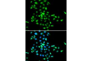 Immunofluorescence analysis of MCF-7 cells using SBDS antibody (ABIN5973483). (SBDS antibody)
