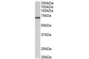 AP31698PU-N (0. (MTHFR antibody  (Internal Region))