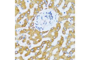 Immunohistochemistry of paraffin-embedded human liver using CCL25 antibody at dilution of 1:100 (40x lens). (CCL25 antibody)