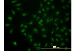 Immunofluorescence of monoclonal antibody to CDC14A on HeLa cell. (CDC14A antibody  (AA 431-530))