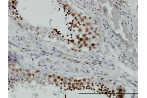 Immunoperoxidase of monoclonal antibody to HMGB2 on formalin-fixed paraffin-embedded human testis.