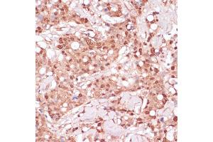 Immunohistochemistry (IHC) image for anti-Bystin-Like (BYSL) (AA 120-280) antibody (ABIN6137672)