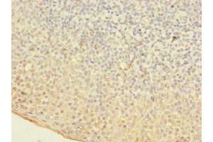 Immunohistochemistry of paraffin-embedded human tonsil tissue using ABIN7160762 at dilution of 1:100 (OGG1 antibody  (AA 1-345))