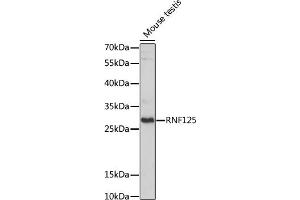 Western blot analysis of extracts of Mouse testis, using RNF125 antibody (ABIN7270057) at 1:1000 dilution. (RNF125 antibody  (AA 1-105))