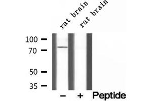 CPT1C antibody