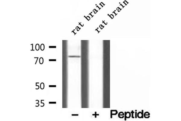 CPT1C antibody