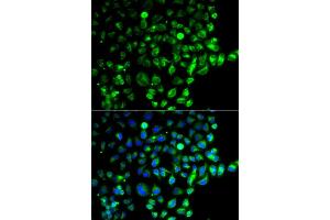 Immunofluorescence analysis of  cells using R antibody (ABIN6128595, ABIN6146569, ABIN6146571 and ABIN6220321). (RAB31 antibody  (AA 1-195))