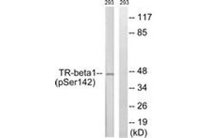 Western blot analysis of extracts from 293 cells treated with PMA 125ng/ml 30', using TR-beta1 (Phospho-Ser142) Antibody. (THRB antibody  (pSer142))