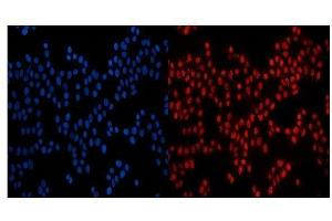 IF analysis of GP210/NUP210 using anti-GP210/NUP210 antibody (ABIN7600707).