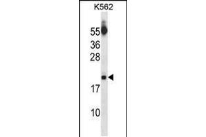 Western blot analysis in K562 cell line lysates (35ug/lane). (SAP18 antibody  (AA 58-86))