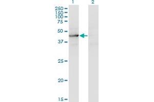 Western Blot analysis of TEX28 expression in transfected 293T cell line by TEX28 monoclonal antibody (M05), clone 1A8. (TEX28 antibody  (AA 1-410))