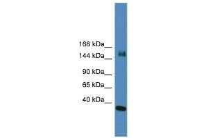 WB Suggested Anti-UTX Antibody Titration:  0.