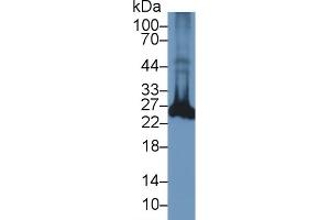 Western Blotting (WB) image for anti-Ubiquitin Carboxyl-terminal Esterase L1 (Ubiquitin Thiolesterase) (UCHL1) (AA 2-223) antibody (ABIN7436393)