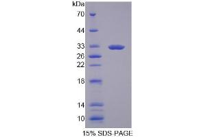 SDS-PAGE analysis of Human GBP3 Protein. (GBP3 Protein)