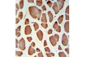 HSD11B2IHC analysis in formalin fixed and paraffin embedded skeletal muscle followed by peroxidase conjugation of the secondary antibody and DAB staining. (HSD11B2 antibody  (Middle Region))