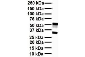 WB Suggested Anti-SOX3 antibody Titration: 1 ug/mL Sample Type: Human heart (SOX3 antibody  (Middle Region))