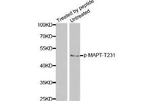 Western Blotting (WB) image for anti-Microtubule-Associated Protein tau (MAPT) (pThr231) antibody (ABIN3020352)