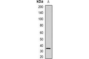 Western blot analysis of NAT1 expression in U937 (A) whole cell lysates.