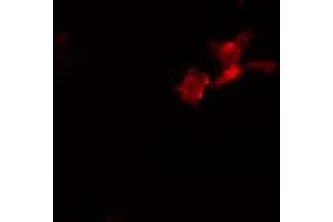 ABIN6274100 staining  HeLa cells by IF/ICC. (PHF1 antibody  (Internal Region))