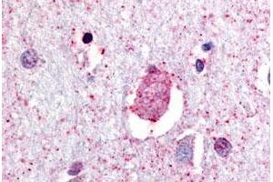 Immunohistochemical (Formalin/PFA-fixed paraffin-embedded sections) staining in human brain, neurons and glia with GPR88 polyclonal antibody . (GPR88 antibody  (C-Term))