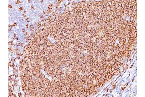 Formalin-fixed, paraffin-embedded human Tonsil stained with CD20 Monoclonal Antibody (L26 + IGEL/773) (CD20 antibody)