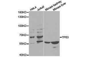 Western Blotting (WB) image for anti-Tumor Protein P63 (TP63) antibody (ABIN1875171) (p63 antibody)