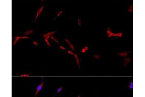 Immunofluorescence analysis of PC-12 cells using CD40L Polyclonal Antibody at dilution of 1:100. (CD40 Ligand antibody)