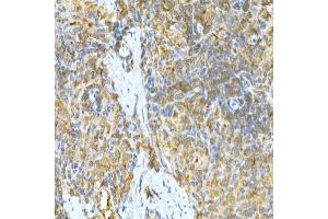 Immunohistochemistry of paraffin-embedded rat spleen using TNF Rabbit pAb (ABIN3022984, ABIN3022985, ABIN3022986 and ABIN6219332) at dilution of 1:50 (40x lens). (TNFAIP3 antibody  (AA 1-190))
