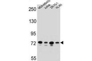 Western Blotting (WB) image for anti-Protocadherin beta 15 (PCDHB15) antibody (ABIN2996491)