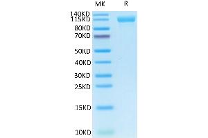 Human Her4/ErbB4 on Tris-Bis PAGE under reduced condition. (ERBB4 Protein (AA 26-651) (Fc Tag))