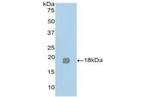 Detection of Recombinant PPARg, Human using Polyclonal Antibody to Peroxisome Proliferator Activated Receptor Gamma (PPARg) (PPARG antibody  (AA 349-488))