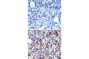 Immunohistochemical analysis of Cd207 in paraffin-embedded formalin-fixed mouse breast tissue using an isotype control (top) and Cd207 polyclonal antibody  (bottom) at 5 ug/mL .