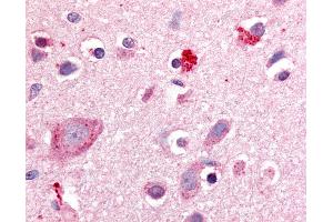 Anti-ROR Beta antibody IHC of human brain, cortex. (RORB antibody  (Hinge Region))