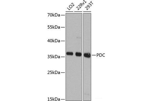 Phosducin antibody