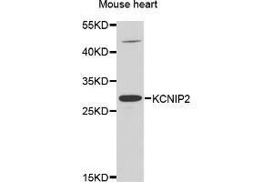 Western blot analysis of extracts of mouse heart, using KCNIP2 antibody. (KCNIP2 antibody)